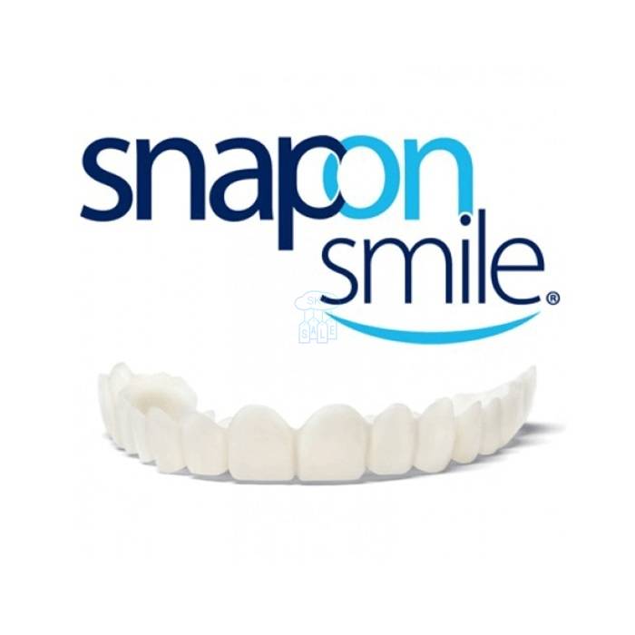 Snap-On Smile - veneer di Chibinong